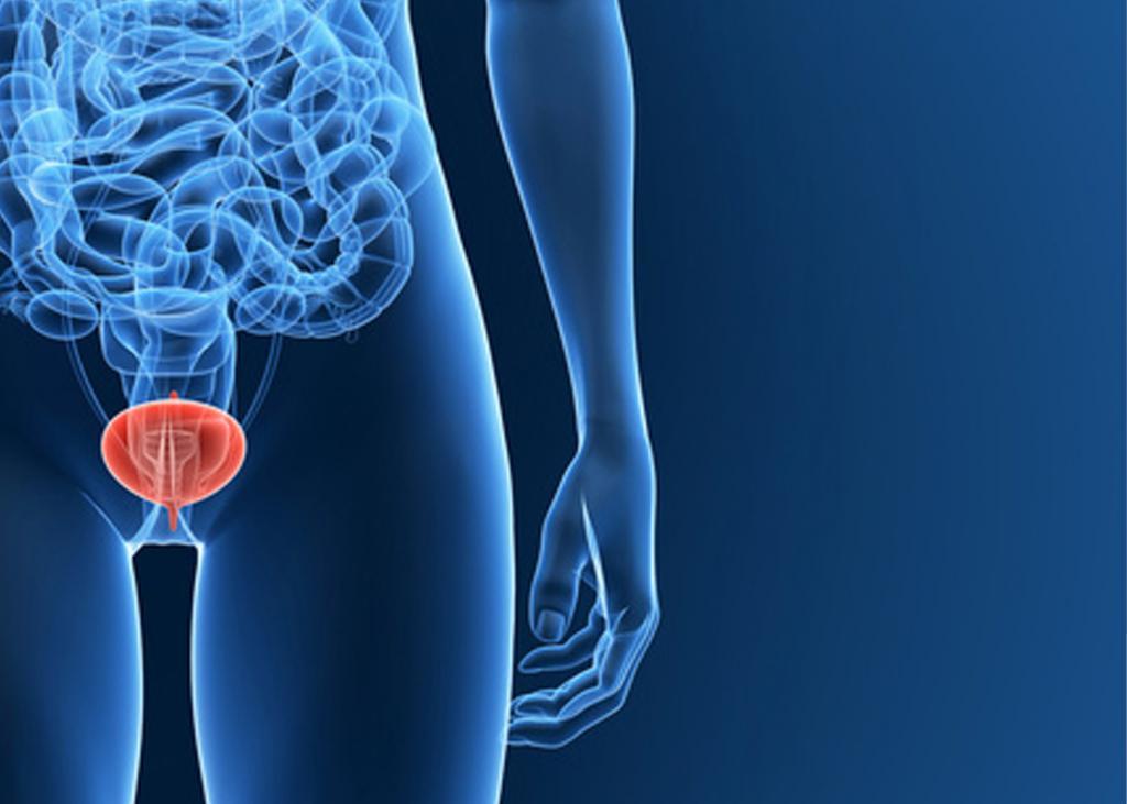 Memahami Cystitis sebagai Bagian dari Perhatian terhadap Kesehatan Perempuan